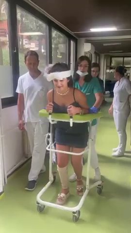 Srpska pevačica doživela tešku nesreću, imala 15 kopči na glavi, a sada mami uzdahe u minijaturnom bikiniju (FOTO)