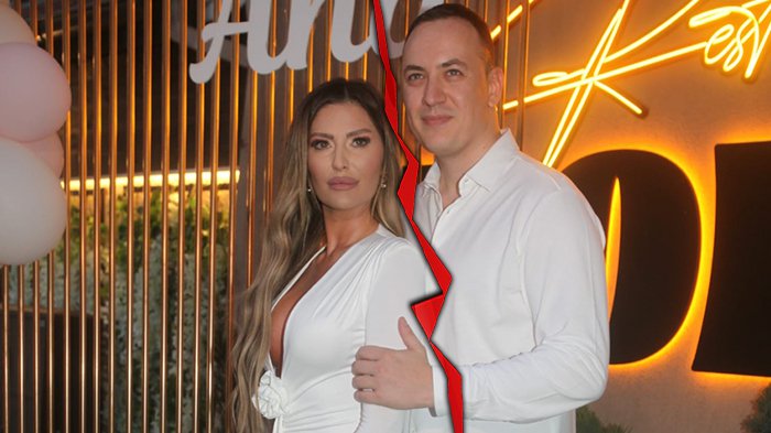 BOTOKS NE RAČUNAM Ana Radulović priznala šta je sve radila na sebi, a evo kako se nosi sa komentarima (FOTO)