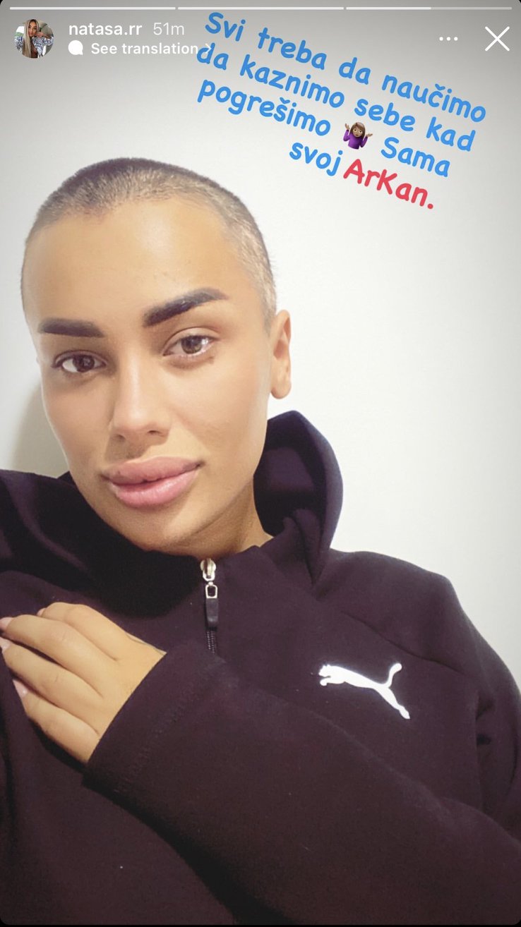 ZBOG SVAĐE S BIVŠIM SE ŠIŠALA NA ĆELAVO! Ovako danas izgleda bivša učesnica ZADRUGE: Gledali smo je u rijalitiju, a onda se skroz povukla iz javnosti, sad izgleda potpuno drugačije (FOTO)