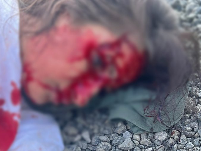 (FOTO) Uznemirujuće slike Sandre Čaprić nakon nesreće, leži u lokvi krvi, Life.ba
