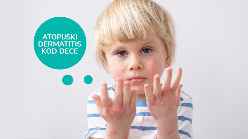 Atopijski dermatitis kod dece pink.rs