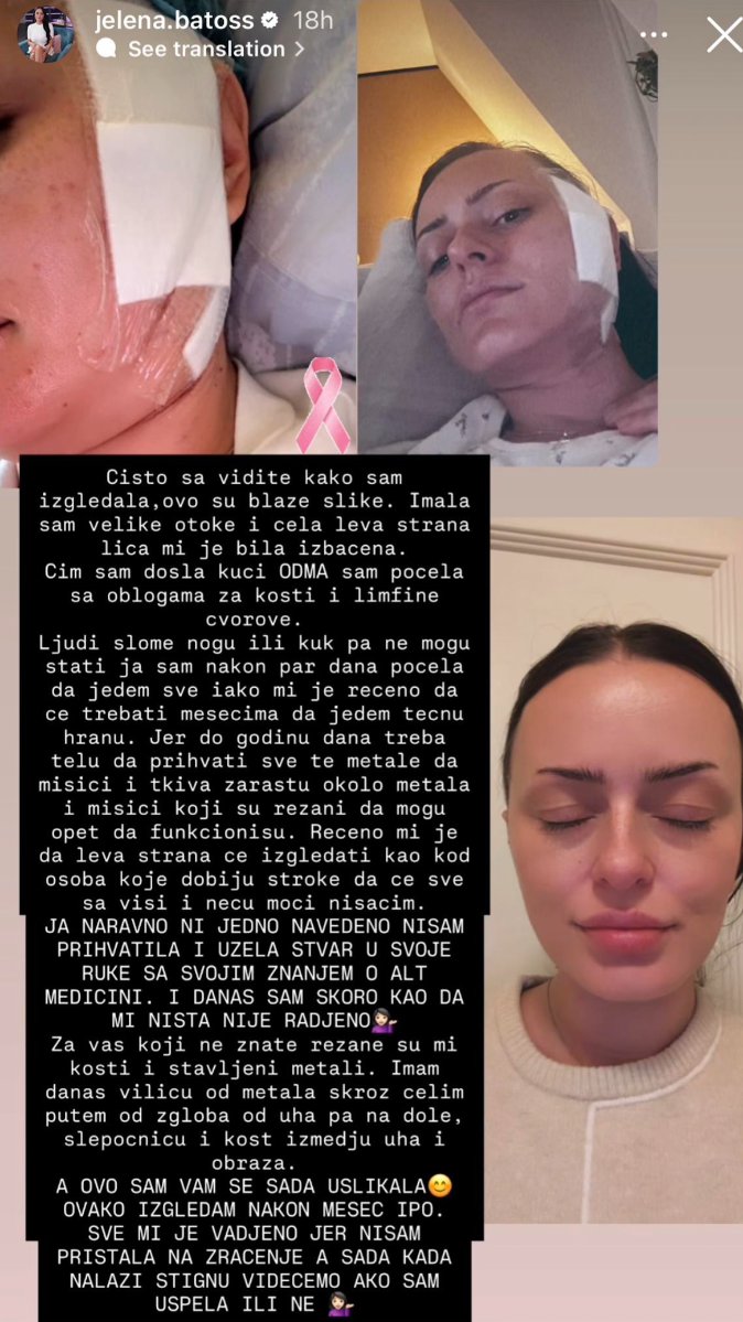 Rezali su mi kosti i stavljali... Bivša zadrugarka imala tešku operaciju nakon dijagnoze raka: Rekli su mi da...