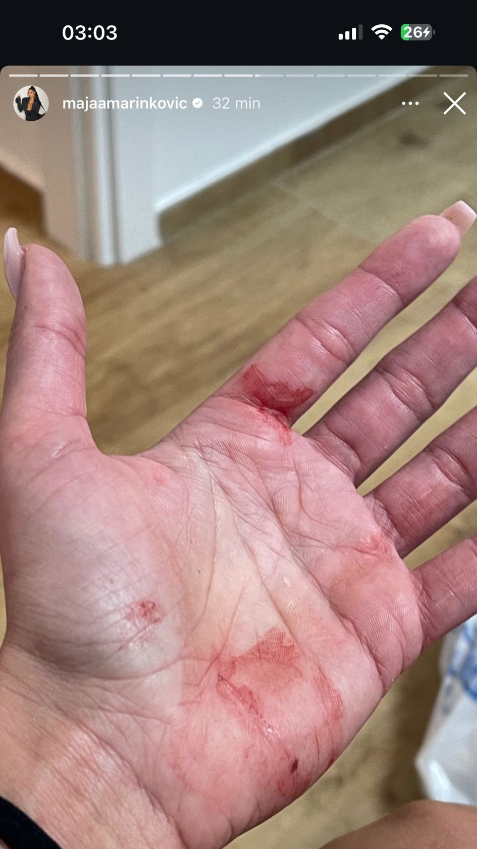 BILI SMO KRVAVI DO KOLENA! Ekskluzivno! Velika ispovest Filipa Cara za Pink.rs nakon što su ga Maja i Aleks optužile da ih je tukao: Krećem u borbu za starateljstvo nad detetom!