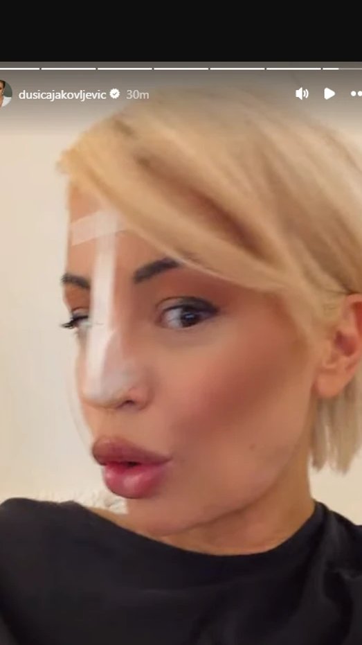 PAO MI JE VRH NOSA! Dušica Jakovljević SKROZ OBLEPILA NOS FLASTERIMA: Javno se oglasila i otkrila metodu kojom rešava problem (FOTO)