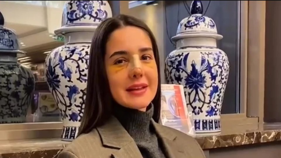 U JEKU GLASINA DA JE RASKINULA S GASTOZOM, Anđela Đuričić operisala NOS: Procurile prve fotke nakon zahvata u Turskoj - velika promena! (FOTO+VIDEO)