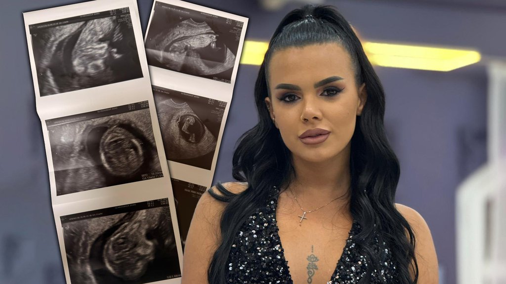 Trudna Anita Stanojlović bila na pregledu kod ginekologa: Osvanuo njen ultrazvuk (FOTO)