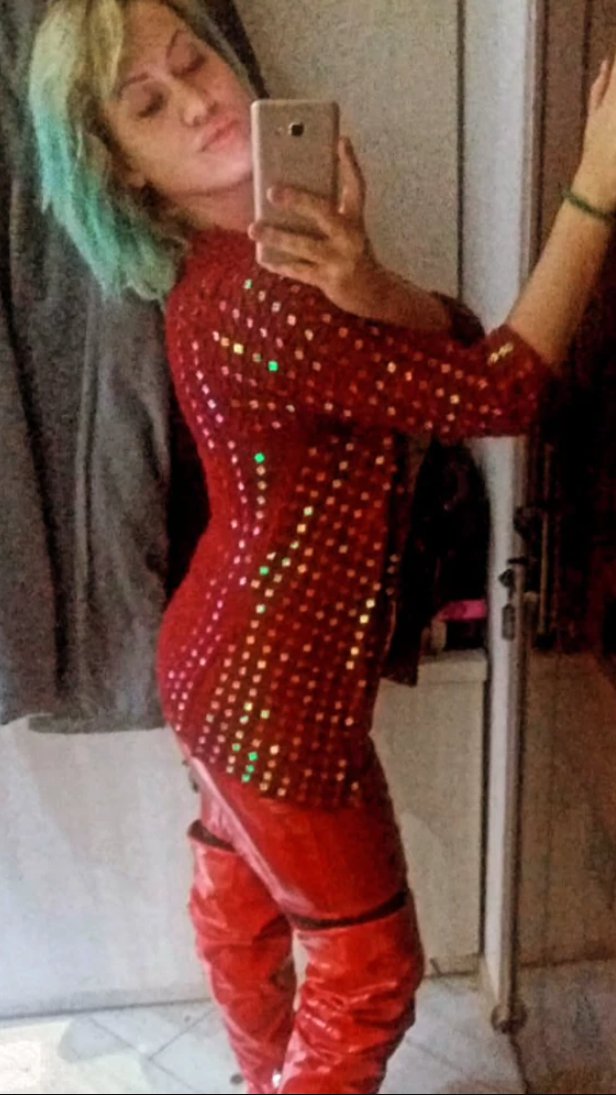 BIVŠA RIJALITI UČESNICA IMA ROZE KUĆU I AUTO, a sad otišla kod plastičara i svi komentarišu da je sa OVIM preterala! (FOTO)