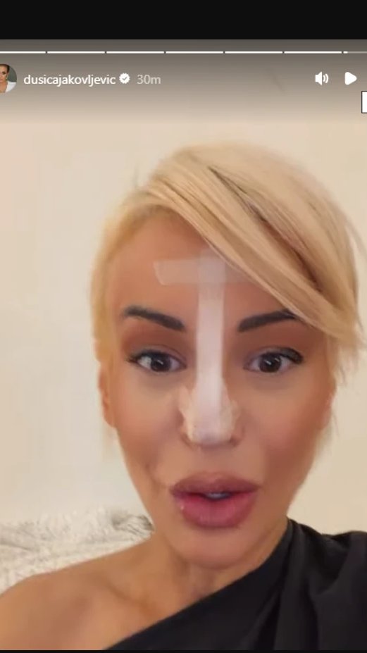 PAO MI JE VRH NOSA! Dušica Jakovljević SKROZ OBLEPILA NOS FLASTERIMA: Javno se oglasila i otkrila metodu kojom rešava problem (FOTO)