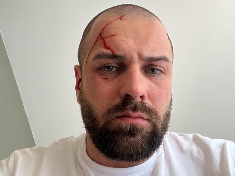 PRVO OGLAŠAVANJE MILANOVOG ROĐENOG BRATA o navodnoj verenici! Tvrdi da nije ni bila trudna: Falsifikovala je dokumente, bila PET PUTA U ZATVORU!