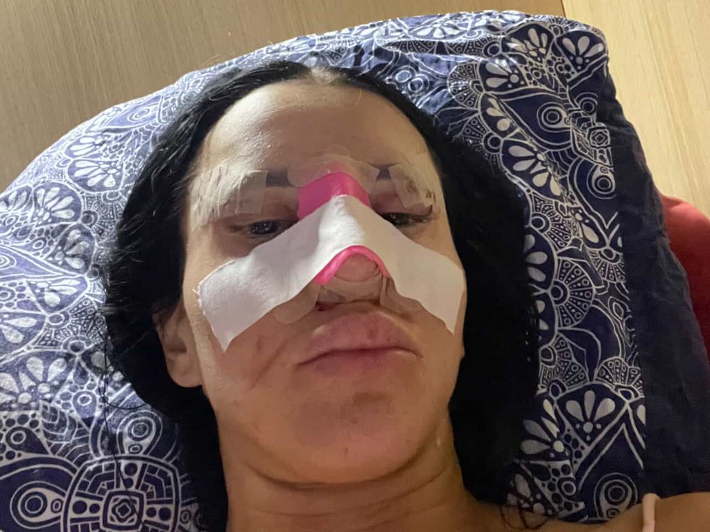 Popila sam tablete za smirenje, NE MOGU DA GLEDAM: Novo oglašavanje Slađe Poršeline, otkrila za Pink.rs kako teče oporavak od operacija: Doktor kaže da...