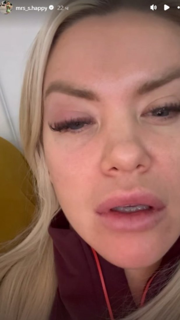 Sanja Stanković uznemirila javnost! Objavila snimak na kom joj je oko OTEČENO, evo šta se dešava! (FOTO)