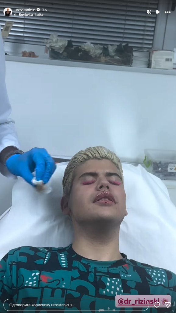 Ponovo iznenadio javnost: Uroš Stanić otišao na novi remont, jedan detalj svima zapao za oko! (FOTO)