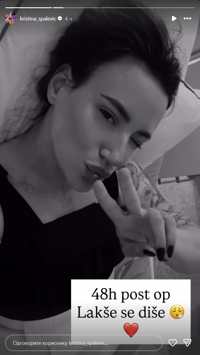 Kristina Spalević odjednom uradila pet estetskih zahvata: Ovako izgleda 48 sati nakon operacije (FOTO)