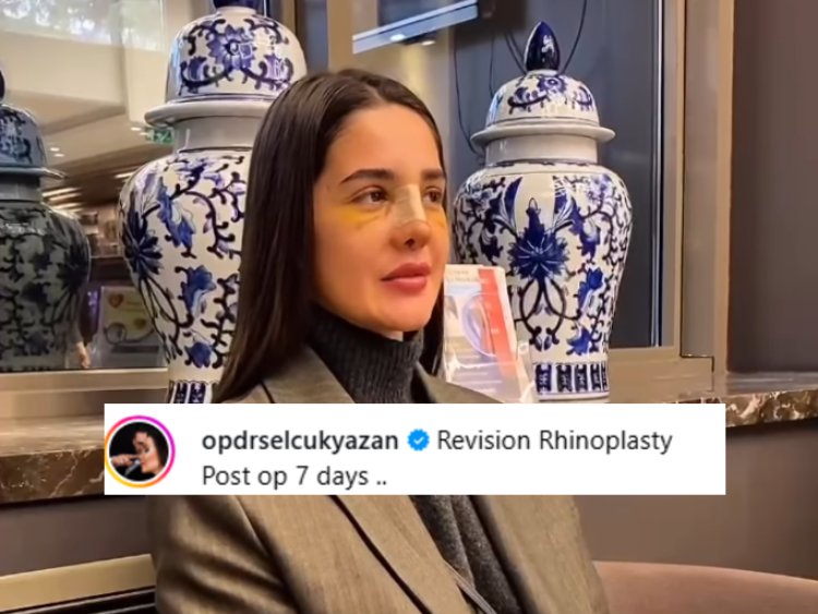 Anđela završila kod hirurga Ane Korać! Turčin od bivše zadrugarke napravio ŽIVU BARBIKU, a onda je na red došla i Đuričićeva: Evo koliko je platila operaciju nosa, NIJE JOJ PRVA?!