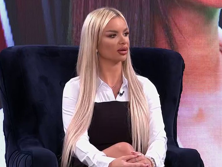 Ovo je put bez povratka! Lice koje se više ne prepoznaje: Evo kako je izgledala Anja Todorović pre estetskih zahvata, a danas je prava BOMBA (FOTO)