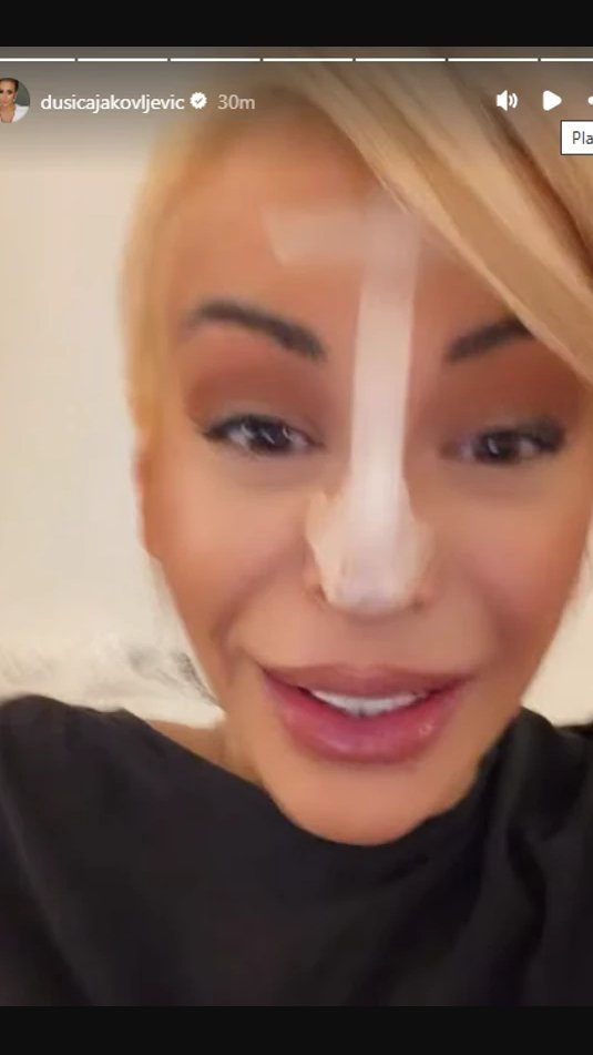 PAO MI JE VRH NOSA! Dušica Jakovljević SKROZ OBLEPILA NOS FLASTERIMA: Javno se oglasila i otkrila metodu kojom rešava problem (FOTO)