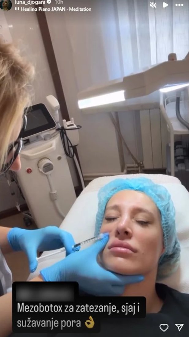 LUNA ĐOGANI OPET KOD PLASTIČARA! Evo šta ovog puta koriguje: Meni je ovo POTREBNO (FOTO)