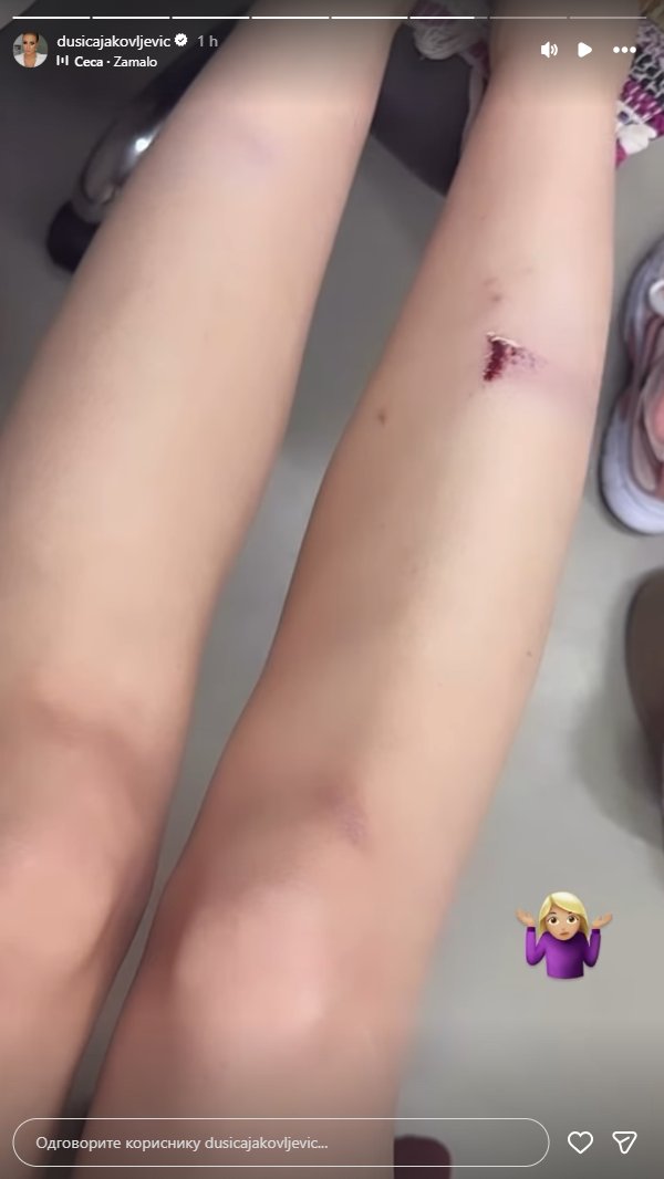 Voditeljka Pink televizije povređena: Dušica Jakovljević objavom na mrežama zabrinula fanove