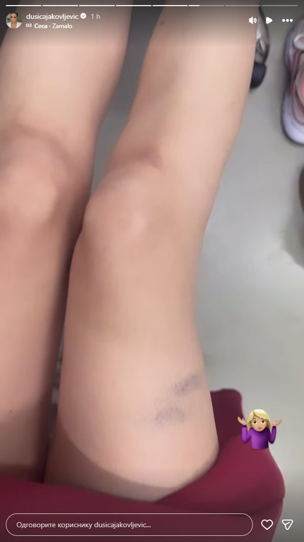 Voditeljka Pink televizije povređena: Dušica Jakovljević objavom na mrežama zabrinula fanove