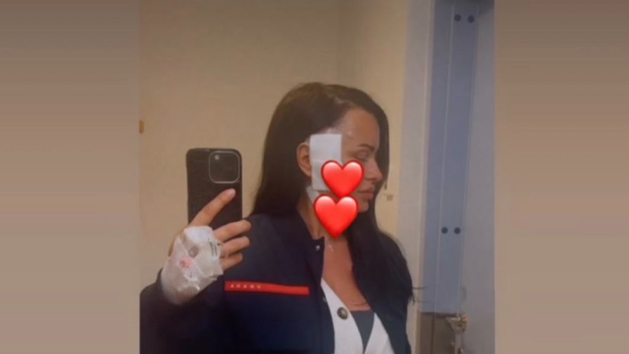 Rezali su mi kosti i stavljali... Bivša zadrugarka imala tešku operaciju nakon dijagnoze raka: Rekli su mi da...