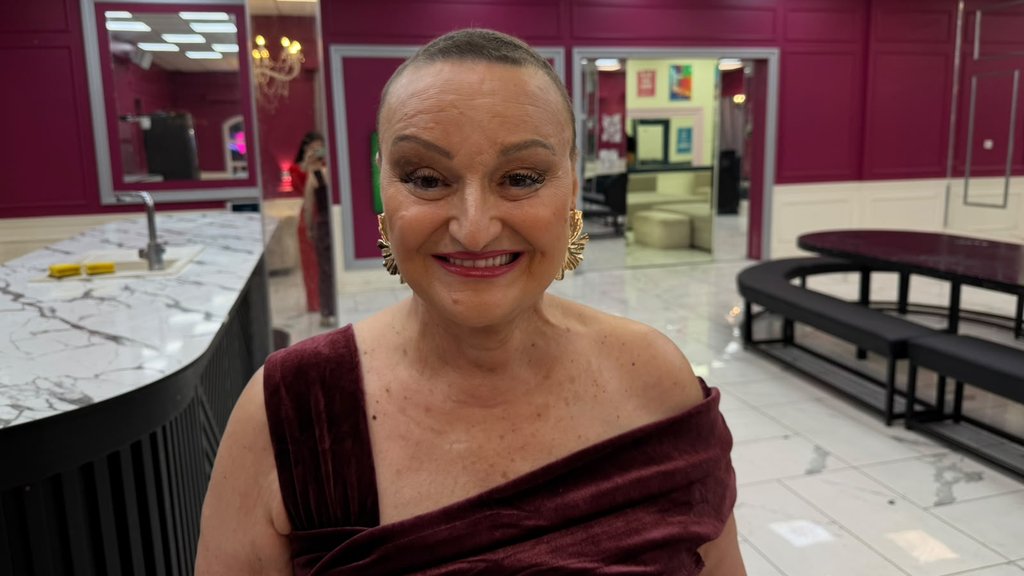 Emotivna ISPOVEST Milice Dugalić o borbi sa OPAKOM BOLEŠĆU! Pojavila se bez PERIKE pred kamerama, pa poslala SNAŽNU PORUKU: Najvažnije je... (FOTO+VIDEO)