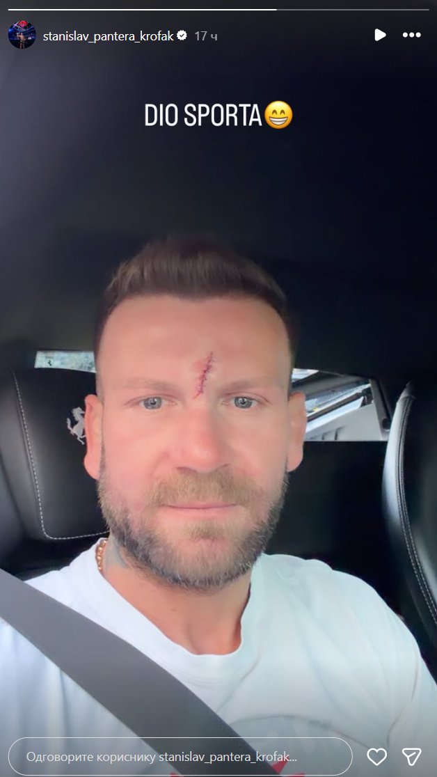OGROMAN OŽILJAK PREKO CELOG ČELA! Stanislav Krofak pokazao lice, fanovi ZABRINUTI! Evo šta mu se desilo! (FOTO)