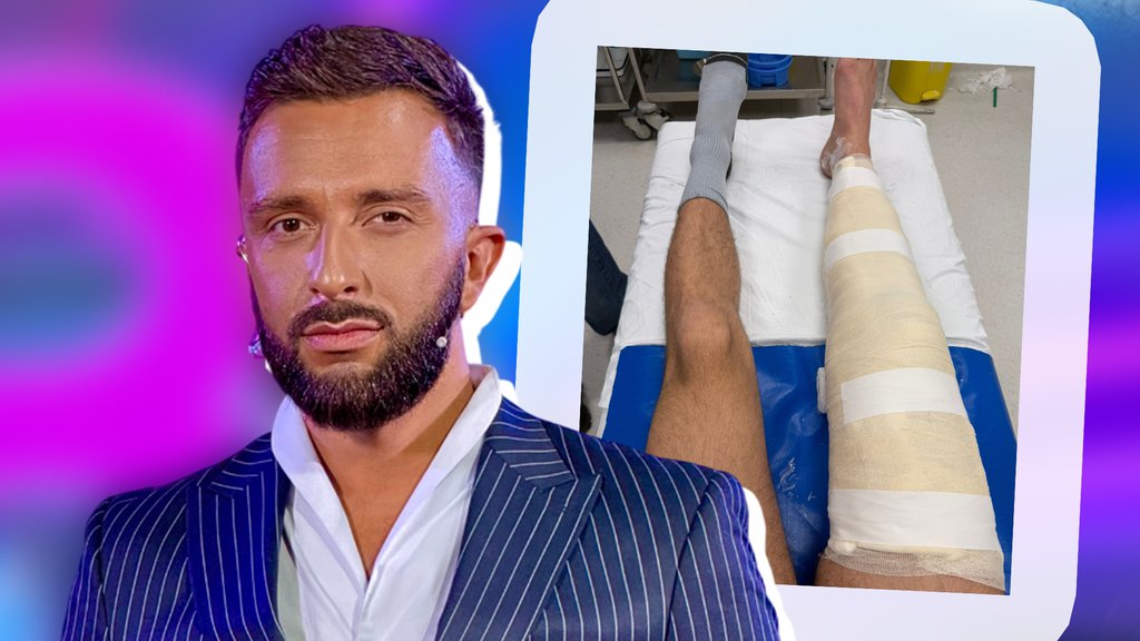 Darko Tanasijević završio u gipsu, a sada zakukao javno: Ja ću poludeti... (FOTO)