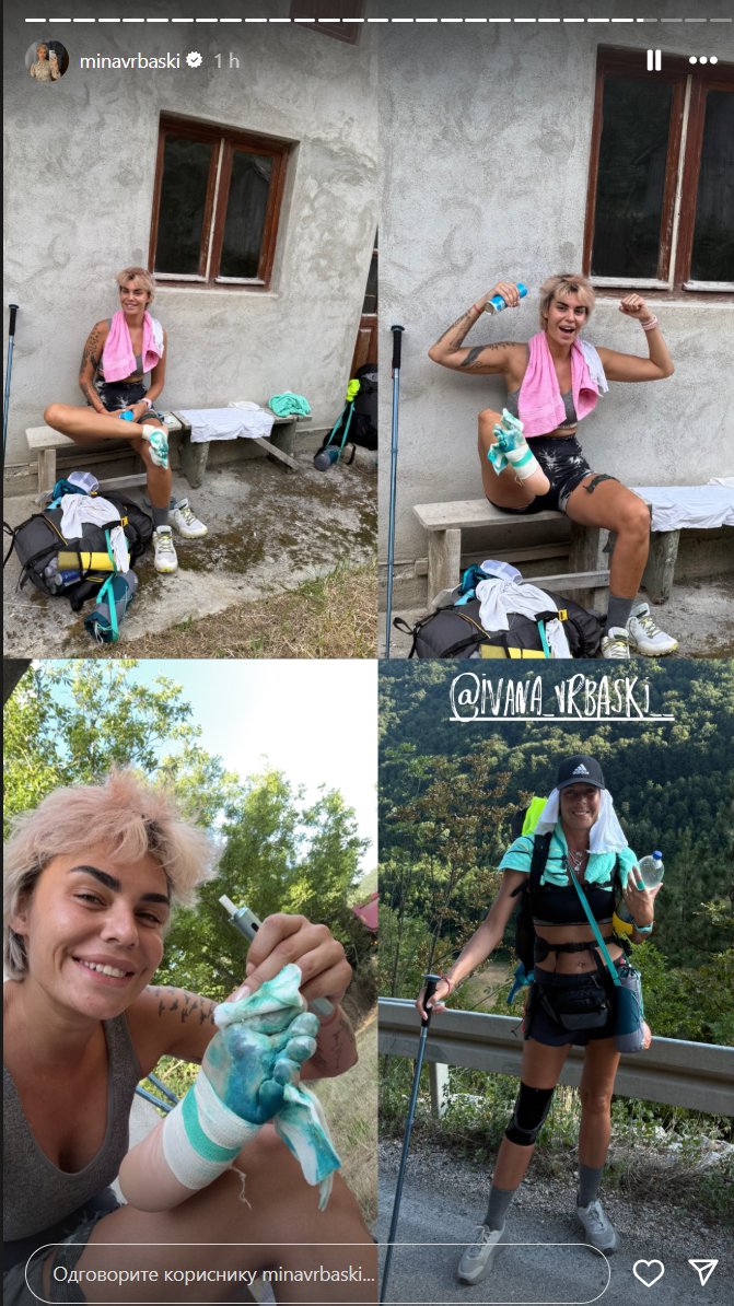 MINA VRBAŠKI LEČI OTVORENE RANE: Pokazala jezive povrede od pešačenja, ali ne odustaje! (FOTO)
