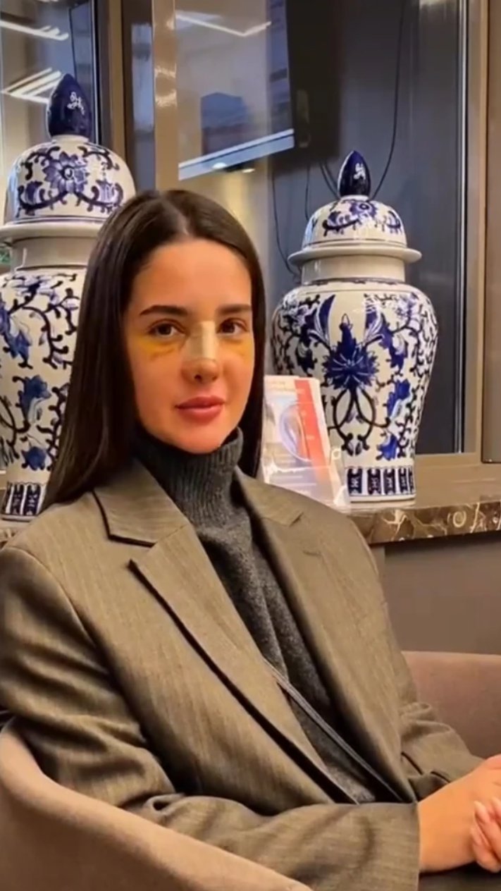 U JEKU GLASINA DA JE RASKINULA S GASTOZOM, Anđela Đuričić operisala NOS: Procurile prve fotke nakon zahvata u Turskoj - velika promena! (FOTO+VIDEO)