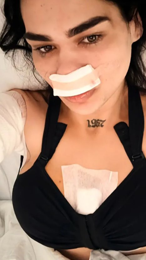 Bivša učesnica Farmera otišla pod nož: Tvrdi da su je unakazili na prethodnoj operaciji, sada uplašena: Objavljen snimak